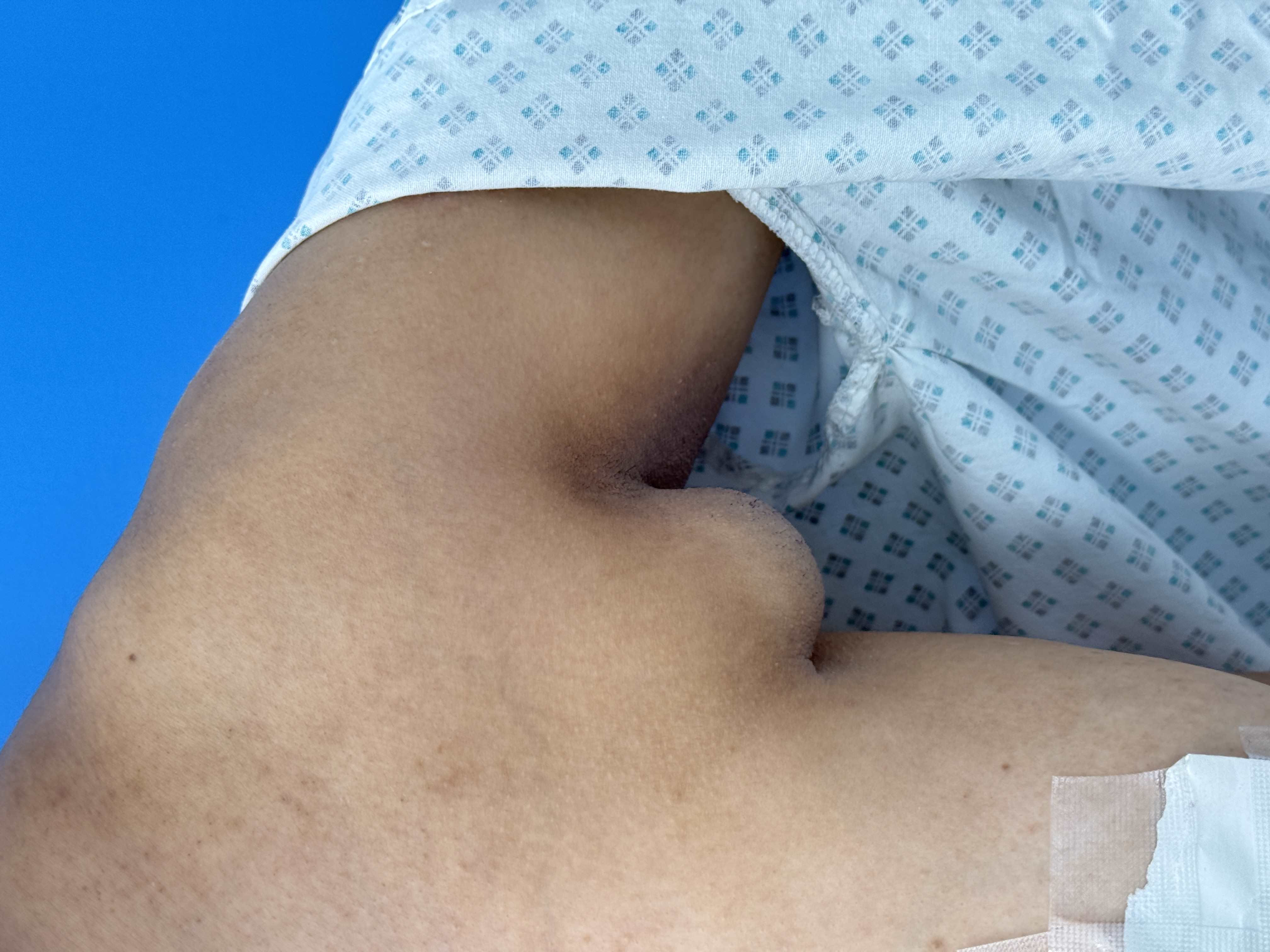surgery arm - Before